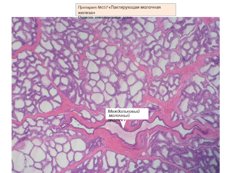 Гистология молочной железы. Лактирующая молочная железа гистология препарат. Молочная железа гематоксилин эозин. Молочная железа окраска гематоксилином и эозином. Нелактирующая молочная железа гистология препарат.