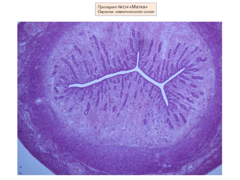 Матка гистология. Матка гематоксилин эозин. Матка гистология препарат. Матка окраска гематоксилин эозин. Гистология половая система препараты.