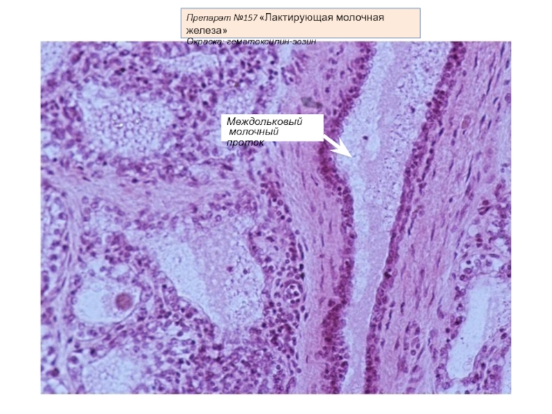 Молочная железа гистология. Молочная железа гематоксилин эозин. Молочная железа окраска гематоксилином и эозином. Лактирующая молочная железа гистология препарат. Нелактирующая молочная железа гистология препарат.