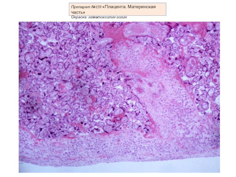 Плацента гистология. Материнская часть плаценты гематоксилин эозин. Материнская часть плаценты гистология препарат. Фибриноид плаценты гистология.