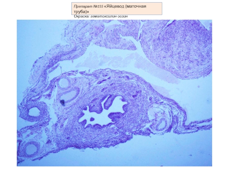 Яйцевод. Маточная труба яйцевод гистология. Яйцевод гистология препарат. Строение яйцевода гистология. Маточная труба гематоксилин эозин.