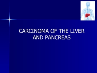 Carcinoma of the liver and pancreas