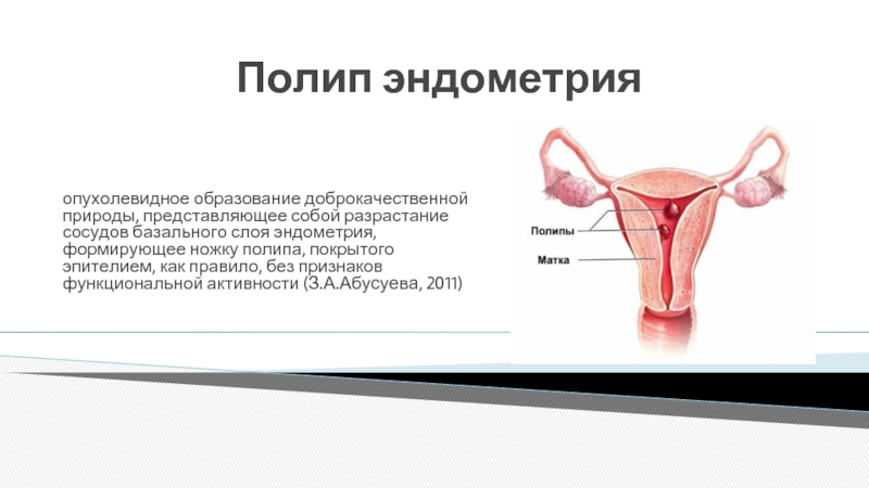 Полип эндометрия размеры. Полипы и гиперплазия эндометрия. Аденоматозные полипы эндометрия.