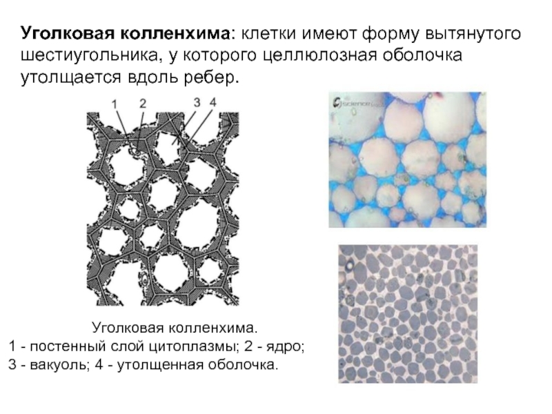 Клетки имеют форму. Пластинчатая колленхима строение. Механические ткани уголковая колленхима. Уголковая колленхима черешка бегонии. Уголковая колленхима строение.