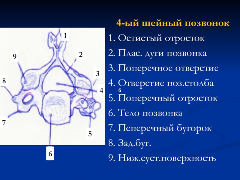 3 шейный позвонок. Отверстия поперечных отростков шейных позвонков. Отросток шейного позвонка. Остистый отросток 2 шейного позвонка. 4 Шейный позвонок.