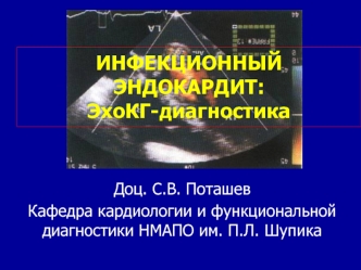 ИНФЕКЦИОННЫЙ ЭНДОКАРДИТ: ЭхоКГ-диагностика