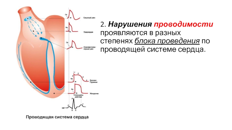 Проводимость сердца. Нарушение проводимости сердца. Нарушение проводимости сердца проявляется. Нарушение проводимости в проводящей системе сердца это. Ответная реакция мышцы на нарушение проводимости.