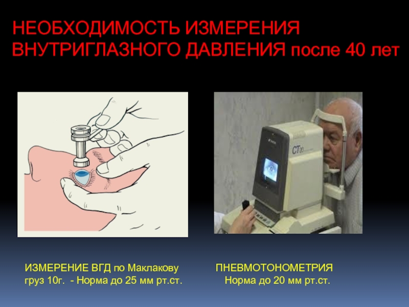 Измерение внутриглазного давления презентация