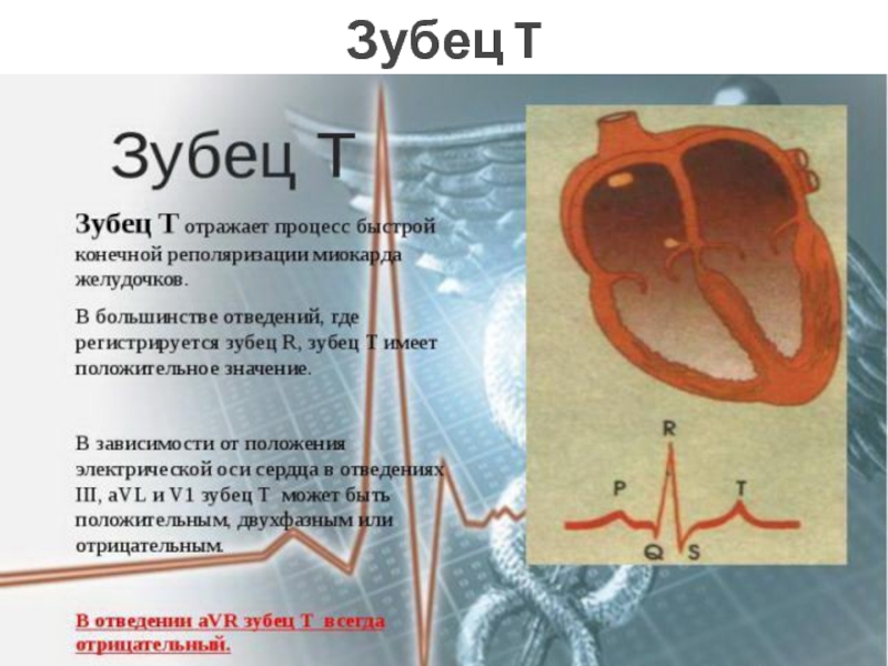 Диффузное нарушение процесса реполяризации сердца