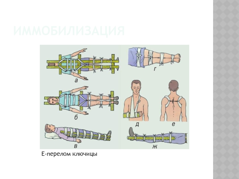 Перелом ключицы карта вызова смп