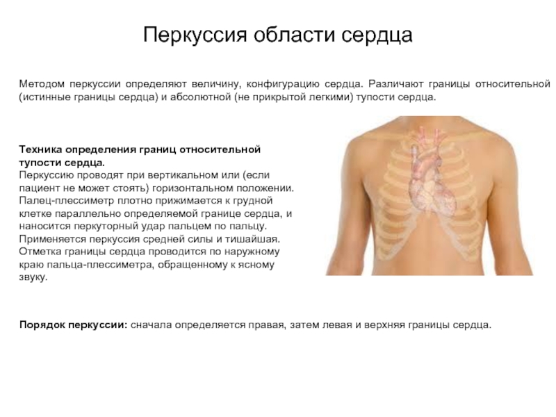 Перкуссия сердца в картинках