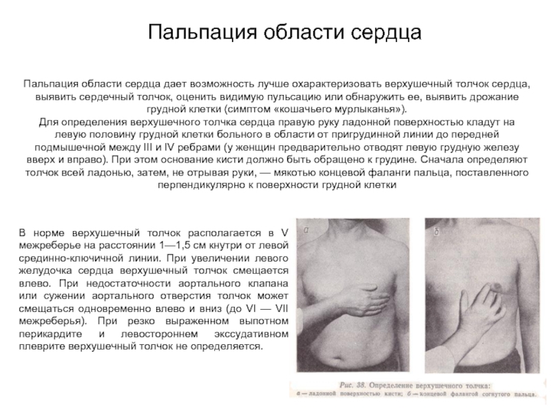 Сердечный определение. Осмотр и пальпация области сердца пропедевтика. Пальпация грудной клетки пропедевтика алгоритм. Пальпация верхушечного толчка сердца. Пальпация сердца пропедевтика внутренних болезней.