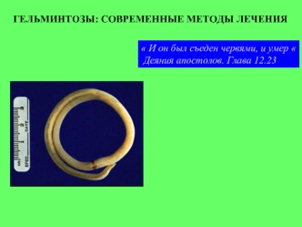 Гельминтозы: современные методы лечения