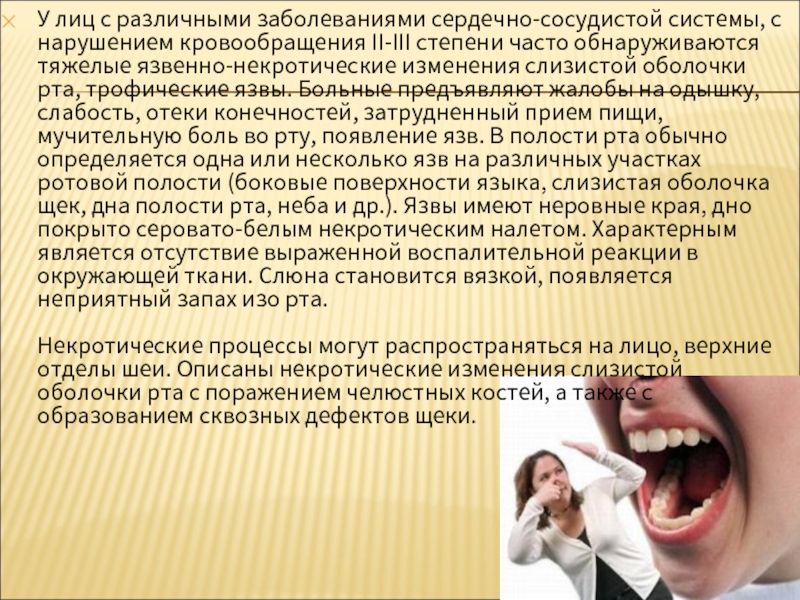 Реферат: Физиотерапия заболеваний слизистой оболочки полости рта