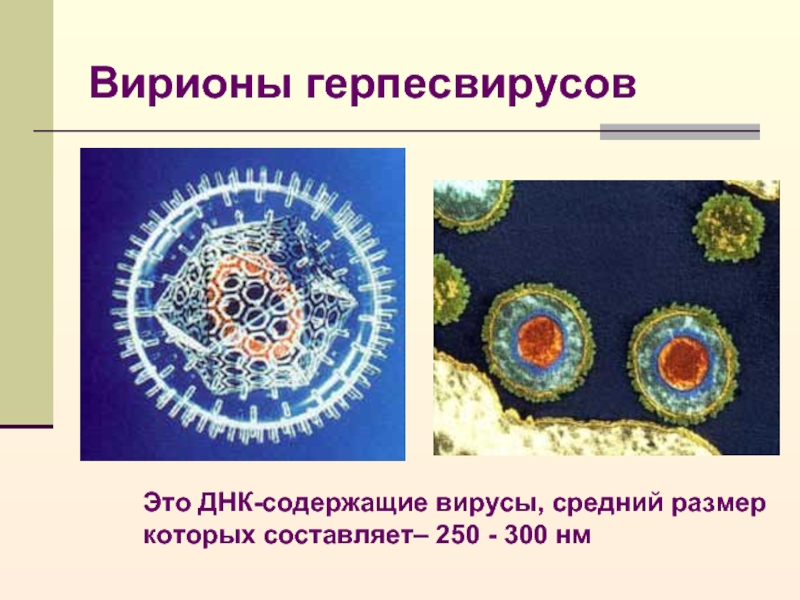 Герпесвирусы микробиология презентация