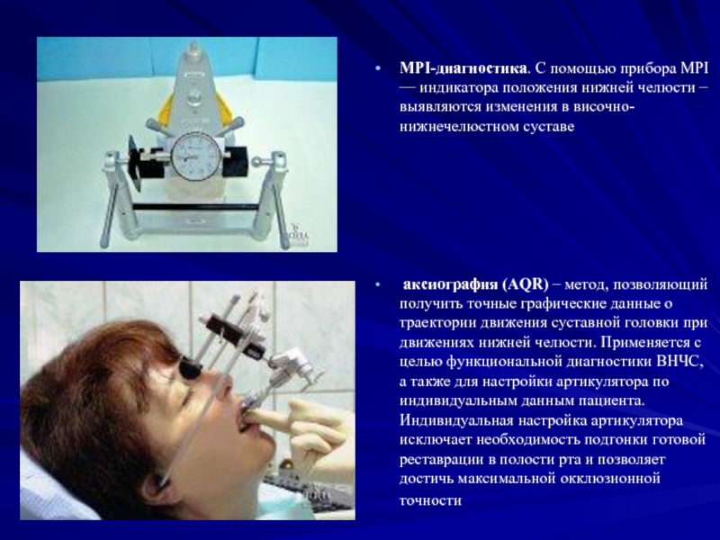 Лучевая диагностика внчс презентация