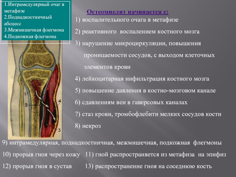 Воспаление костного мозга сустава. Воспаление костного мозга. Реактивные изменения костного мозга что это. Воспалительные изменения костного мозга. Остеомиелит костного мозга.