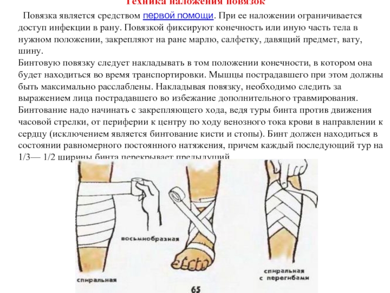 Фиксация хода. При наложении повязки на конечность следует:. Фиксирующие ходы при наложении повязки. Фиксирующий ход повязки это. Правила наложения фиксирующих повязок.