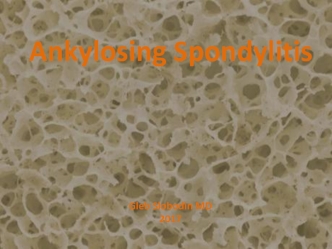 Ankylosing Spondylitis