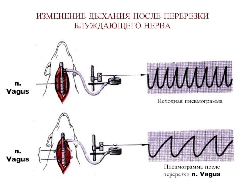 Изменилось дыхание. Пневмограмма после гиперпноэ. Пневмограмма периодического дыхания. Пневмограмма дыхания Биота. При перерезке блуждающего нерва дыхание.