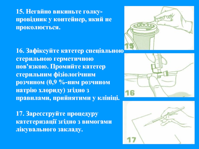 Показания постановки катетера. Постановка катетера венозного алгоритм. Извлечение венозного катетера алгоритм. Алгоритм постановки периферического венозного катетера. Постановка периферического катетера алгоритм Сестринское дело.