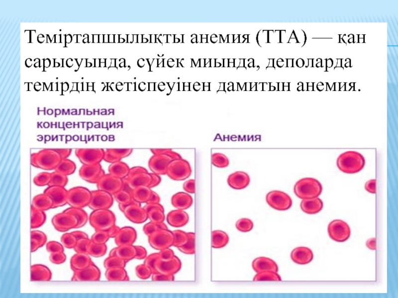 Анемии презентация по терапии