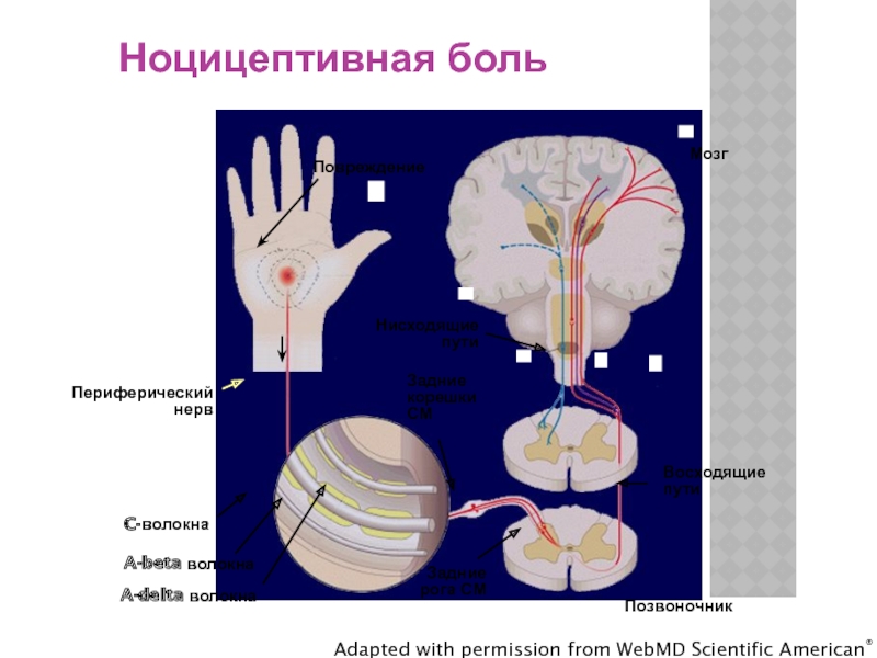 Ноцицептивная боль схема