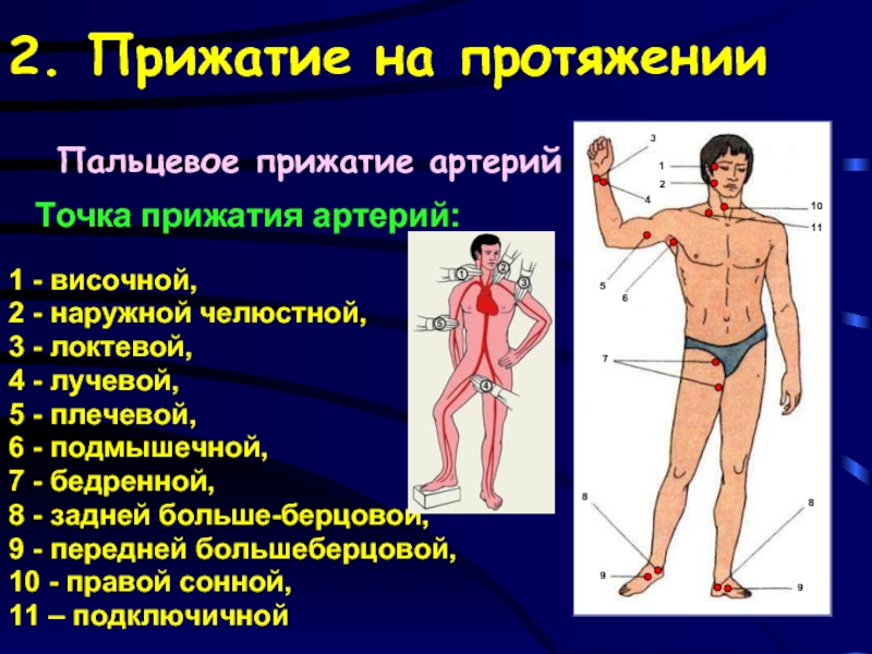 Прижатие сонной артерии производится