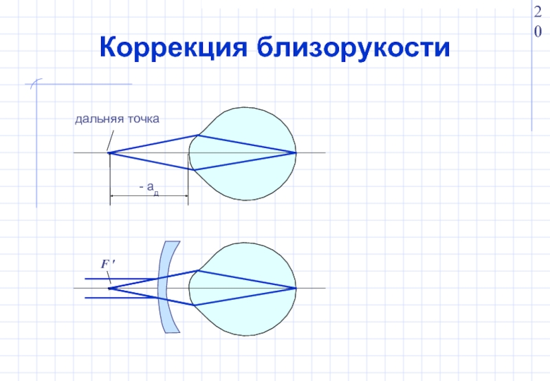 Схема коррекции близорукости