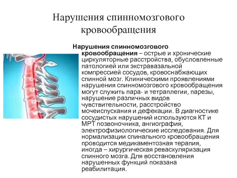 Экстравазальная компрессия артерий