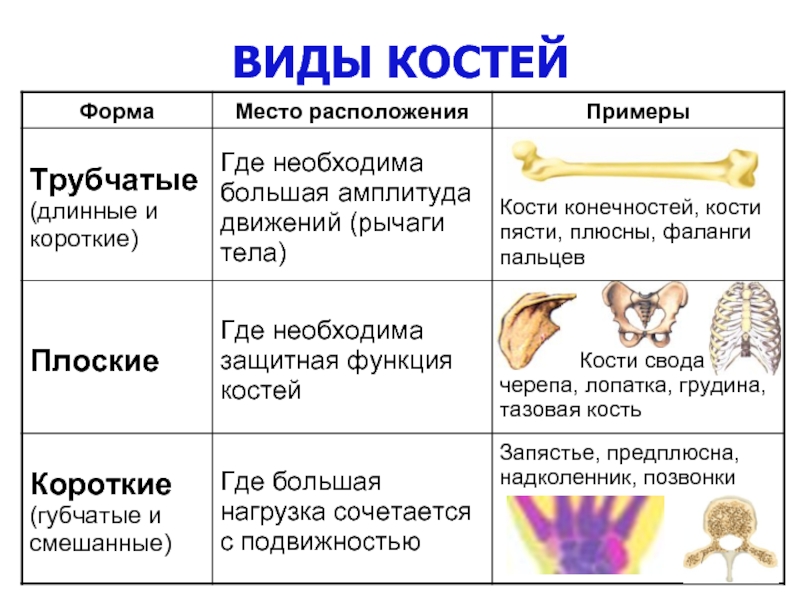 Кость изображенная на рисунке относится к костям