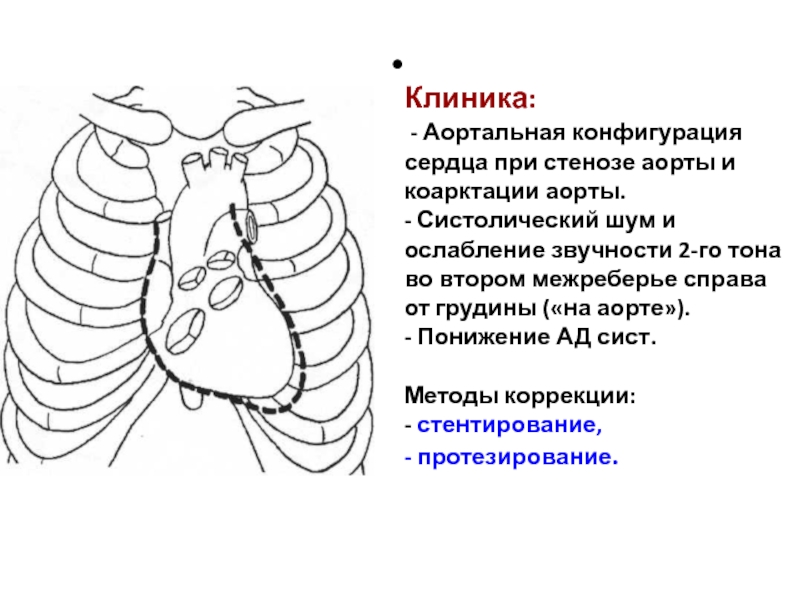 Нормальная конфигурация сердца рисунок