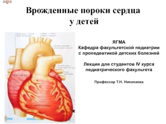 Врожденные пороки сердца у детей