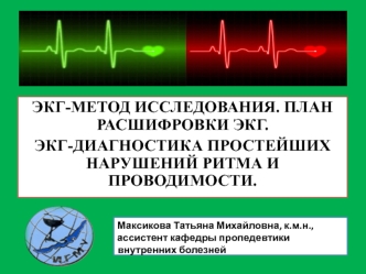 ЭКГ-метод исследования. План расшифровки ЭКГ. ЭКГ-диагностика простейших нарушений ритма и проводимости