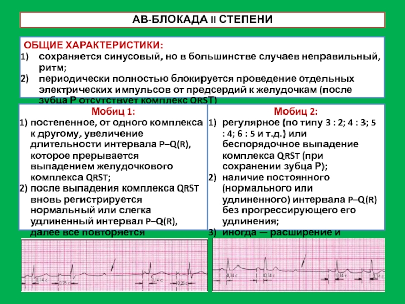 Давление блокада. ЭКГ АВ блокада 1. Av блокада 2 ст на ЭКГ. АВ блокада степени на ЭКГ признаки. Ab блокада 2 степени ЭКГ признаки.