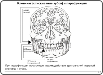 Кленчинг (стискивание зубов) и парафункция