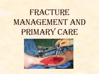 Fracture Management and Primary Care