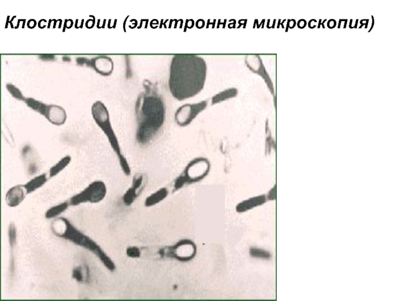 Клостридии фото микроскопия