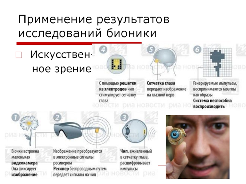 Бионический протез презентация