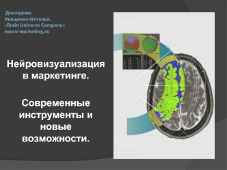 Нейровизуализация в маркетинге. 

Современные инструменты и новые возможности.