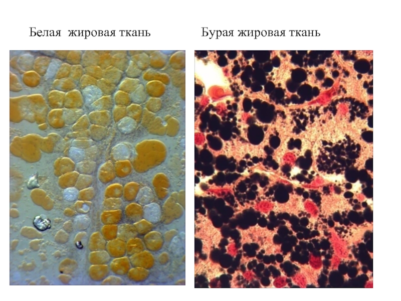 Бурая жировая ткань фото Соединительные ткани