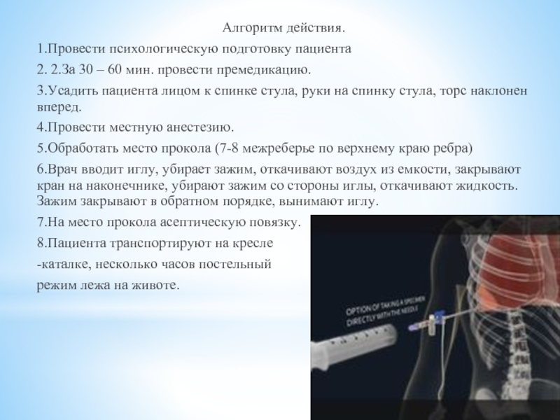 Плевральная пункция. Проведение плевральной пункции алгоритм. Плевральная пункция алгоритм выполнения. Пункция плевральной полости алгоритм. Ассистирование при проведении врачом плевральной пункции алгоритм.