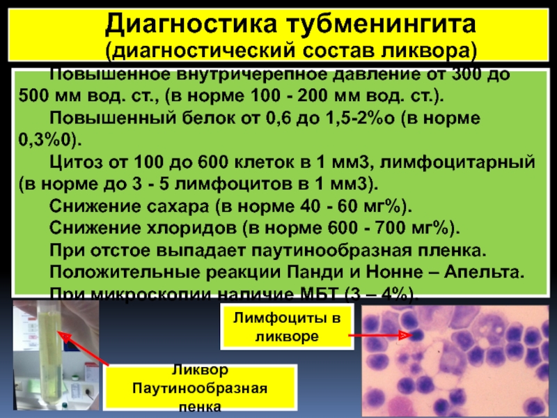 Пцр ликвора. Цитоз цереброспинальной жидкости. Давление спинномозговой жидкости в норме. Цитоз в ликворе норма. Повышенный цитоз в ликворе.