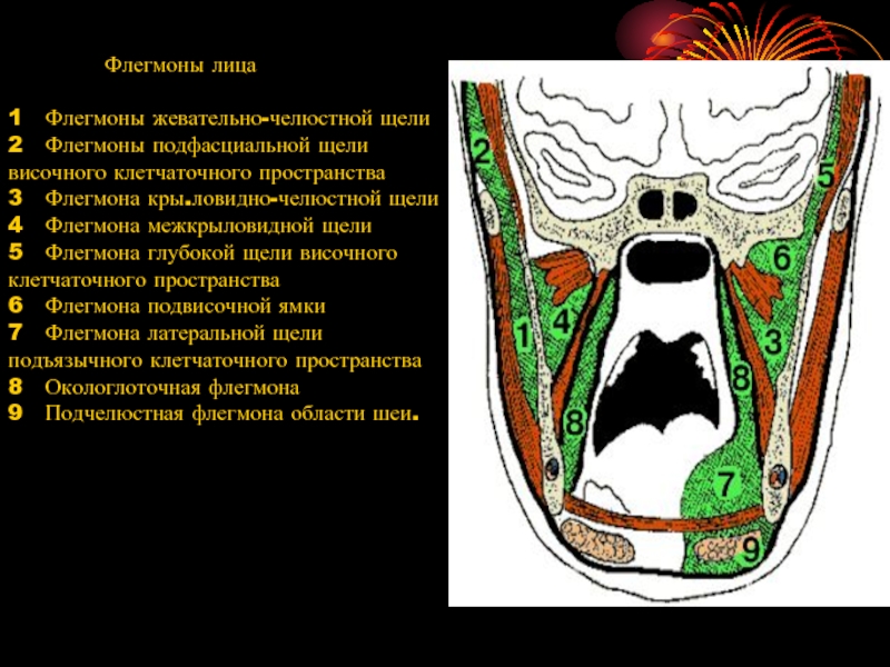 Флегмона крылонебной ямки. Пространства глубокой области лица. Жевательно челюстное клетчаточное пространство.