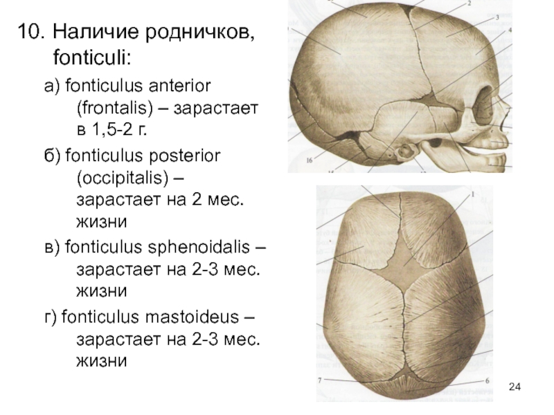 Типы родничков. Роднички черепа анатомия. Швы и роднички черепа анатомия. Роднички черепа новорожденного. Топография черепа роднички.