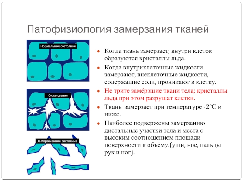 Патогенез отморожения схема