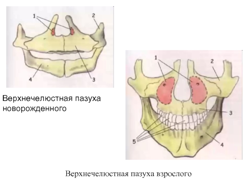 Правая верхнечелюстная пазуха где находится картинка