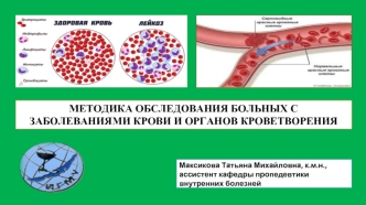 Больные с заболеваниями крови и органов кроветворения