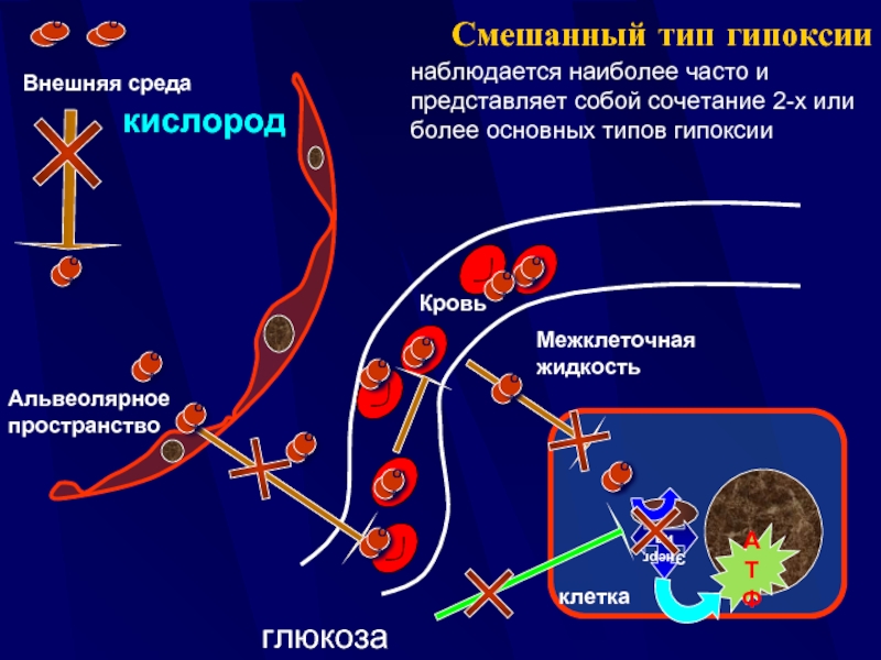 Гипоксия этиология патогенез. Патогенез смешанной гипоксии. Смешанная гипоксия этиология. Гипоксия смешанного типа. Смешанная гипоксия патогенез.