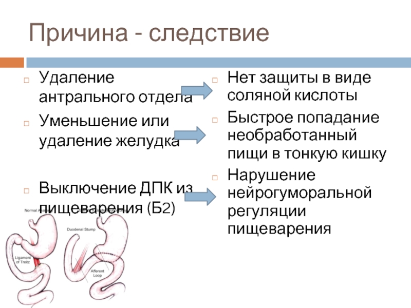 Осложнения ампутации